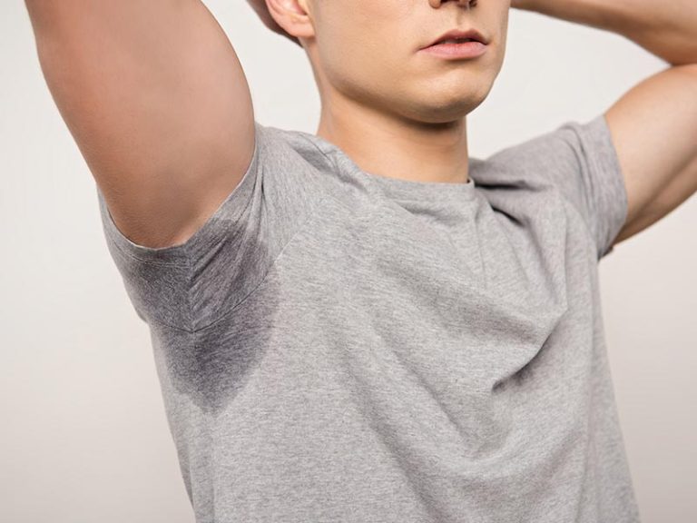 Hyperhidrosis